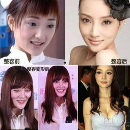 那些整容失败的明星网红,明星网红的美丽代价