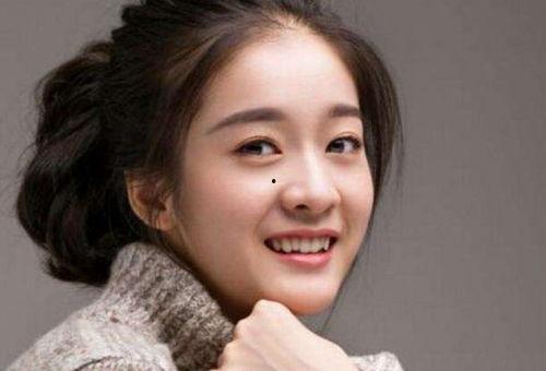 坏牙明星网红叫什么